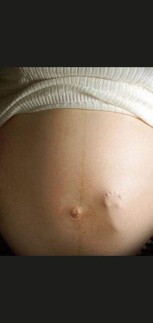 Empreinte f&oelig;tale inqui&eacute;tante