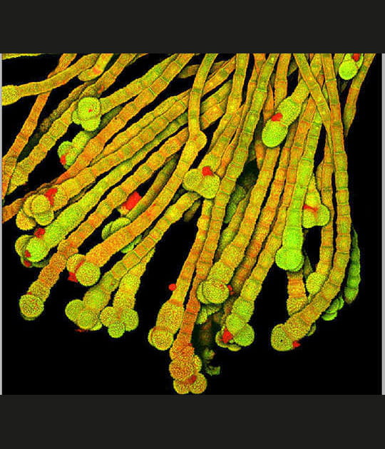 Enchev&ecirc;trement de poils