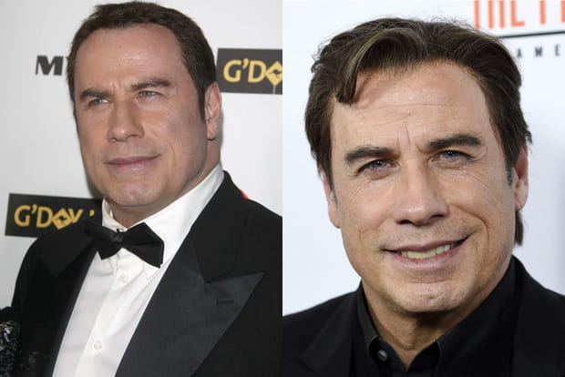 John Travolta s'est fait des implants capillaires