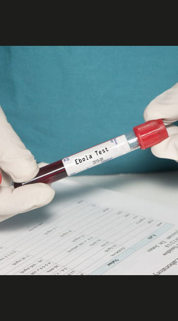 Comment attrape-t-on Ebola&nbsp;?