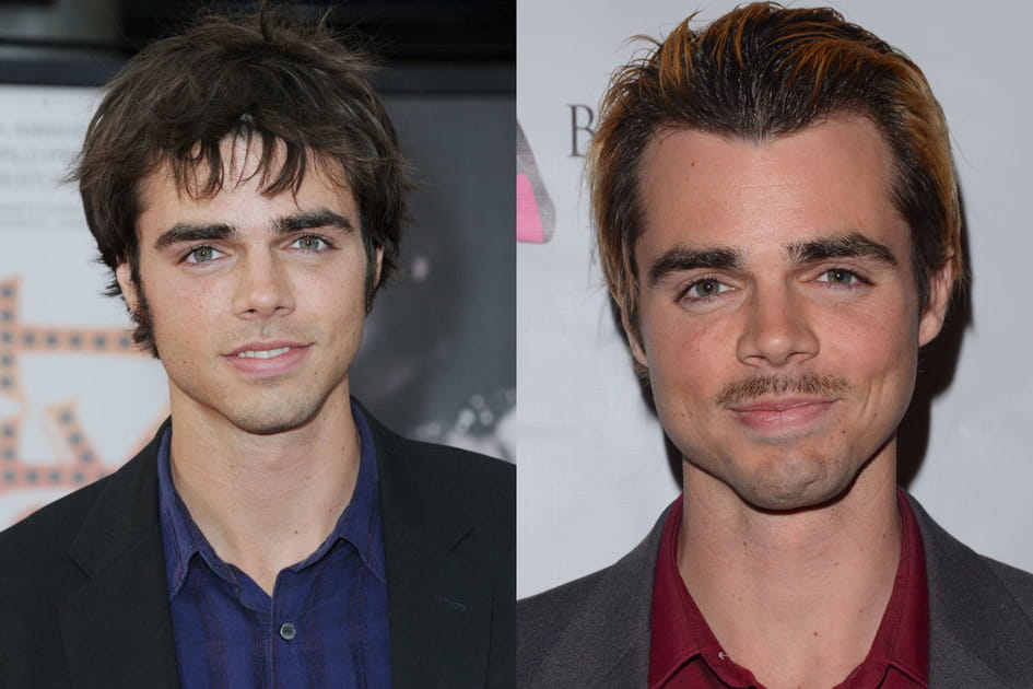 Reid Ewing accro &agrave; la chirurgie esth&eacute;tique