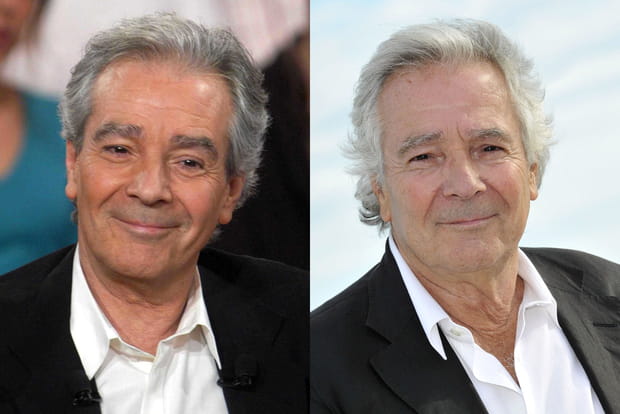 Pierre Arditi a changé de paupières