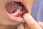 "Je ne donnerais jamais ça à mes enfants" : l'alerte des dentistes
