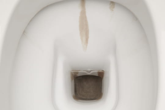 Comment se d&eacute;barrasser des traces brunes sur la cuvette des toilettes&nbsp;: avec cette astuce, &ccedil;a marche &agrave; tous les coups