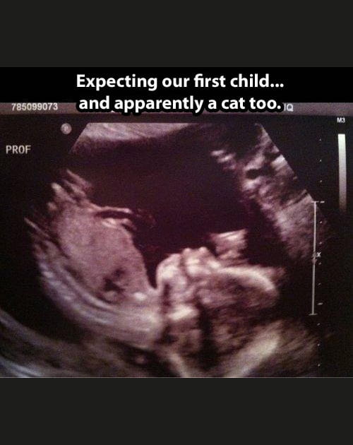 Un chat se cache dans cette &eacute;chographie