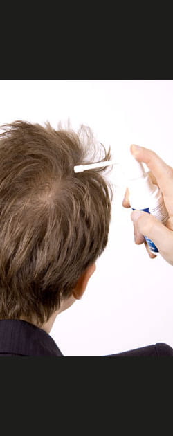 Et si je perds mes cheveux&nbsp;?