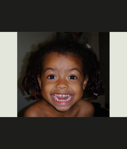 Sourire dent&eacute;