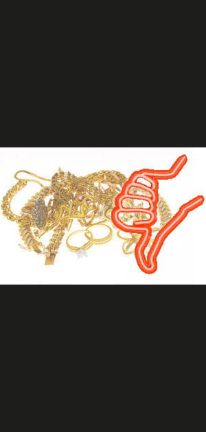 Les objets pr&eacute;cieux soumis aux&nbsp;pr&eacute;l&egrave;vements sociaux