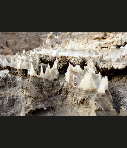 Dents ac&eacute;r&eacute;es
