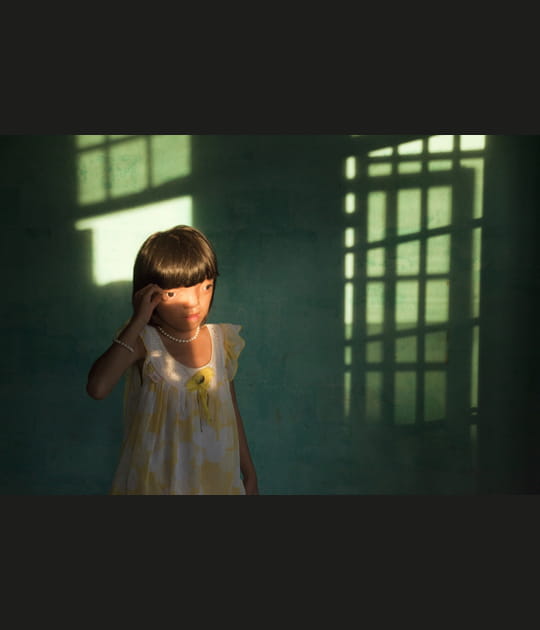 Suffers from Agent Orange disabilities