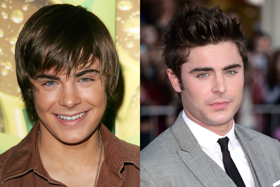 Zac Efron se serait fait refaire le nez