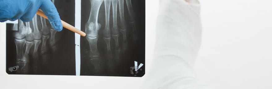 Apr&egrave;s 50&nbsp;ans, il faut &eacute;viter de manger ces aliments&nbsp;: ils sont mauvais pour les os