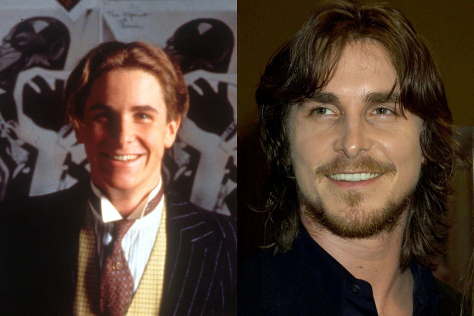Christian Bale n'a plus les m&ecirc;mes dents