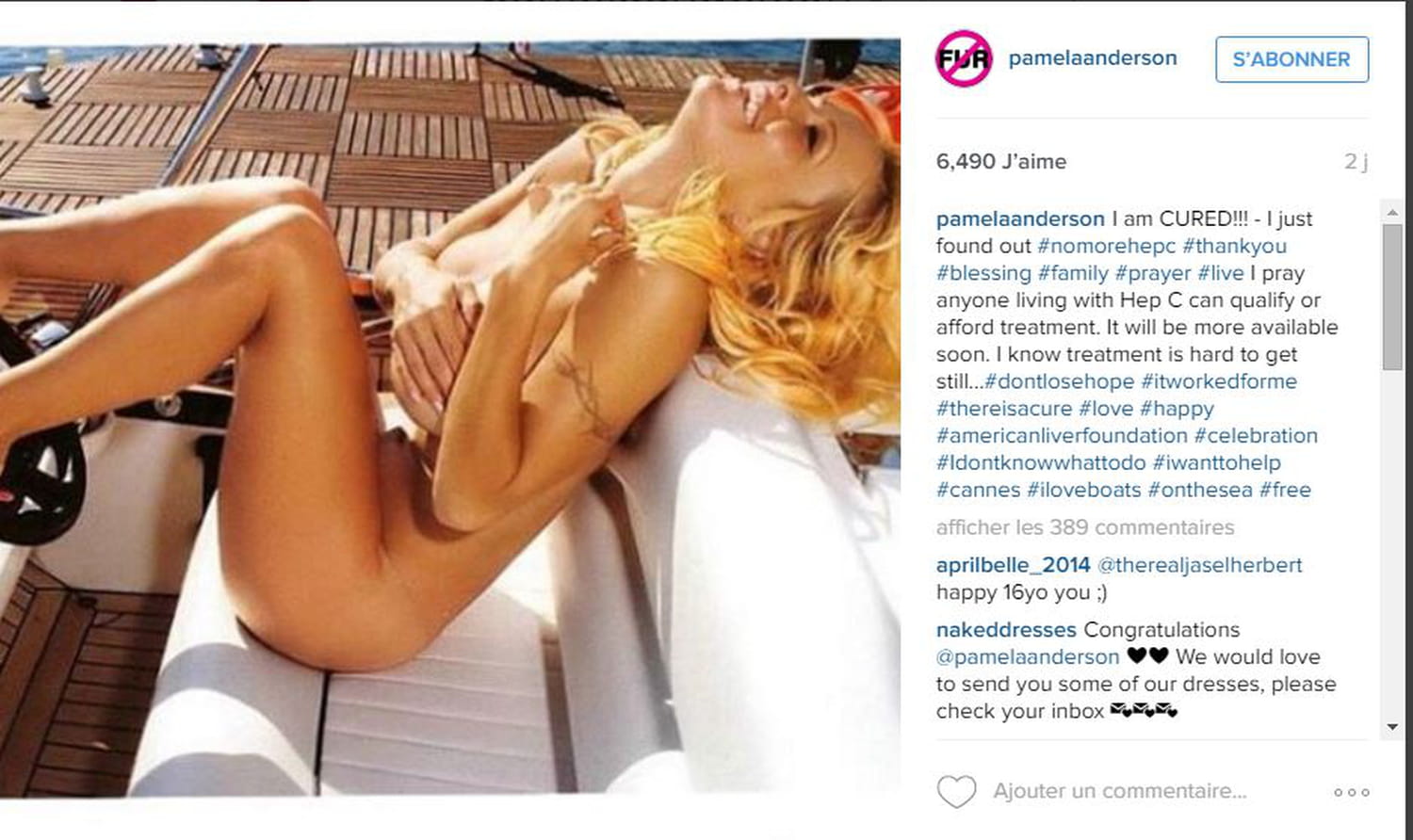 Pamela Anderson et l'hépatite C : une sale maladie transmise par son ex-mari Tommy Lee ?