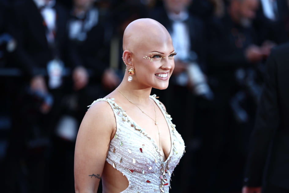 L'influenceuse Emma Combs, qui souffre d'alop&eacute;cie, &eacute;tait pr&eacute;sente jeudi &agrave; Cannes
