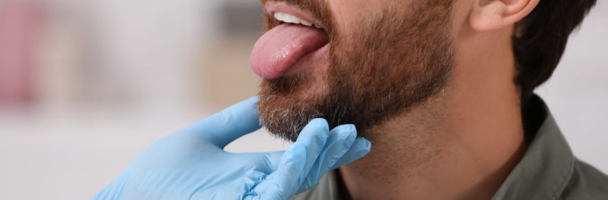 La maladie de Charcot d&eacute;tect&eacute;e plus t&ocirc;t gr&acirc;ce &agrave; notre langue&nbsp;? Ce d&eacute;tail pourrait &ecirc;tre un signe pr&eacute;coce
