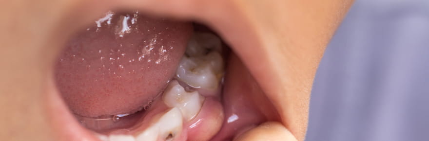 &quot;Je ne donnerais jamais &ccedil;a &agrave; mes enfants&quot;&nbsp;: l'alerte des dentistes