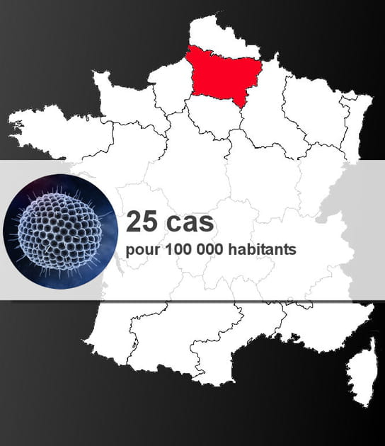 4e r&eacute;gion la plus touch&eacute;e par la varicelle : la&nbsp;Picardie