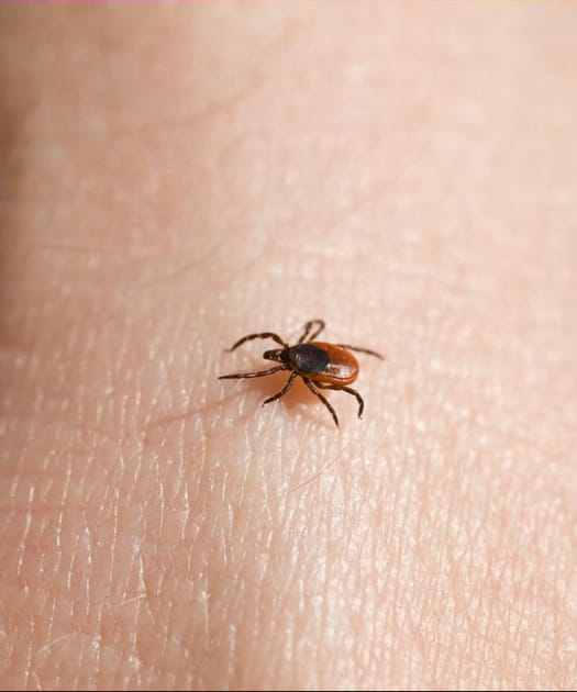 La maladie de Lyme, via la tique