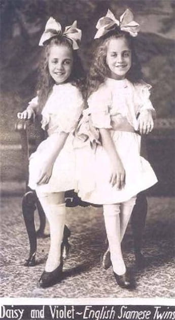 Daisy et Violet Hilton