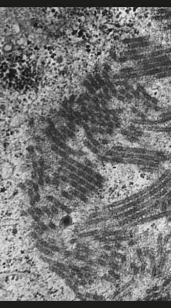 Virus&nbsp;Ebola&nbsp;: une virulence extr&ecirc;me