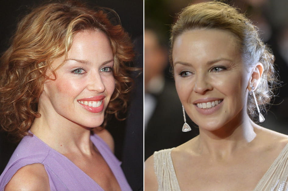 Kylie Minogue