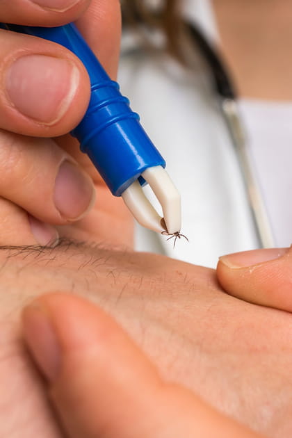 Quel est le risque de contracter la maladie de Lyme apr&egrave;s une piq&ucirc;re de tique&nbsp;?