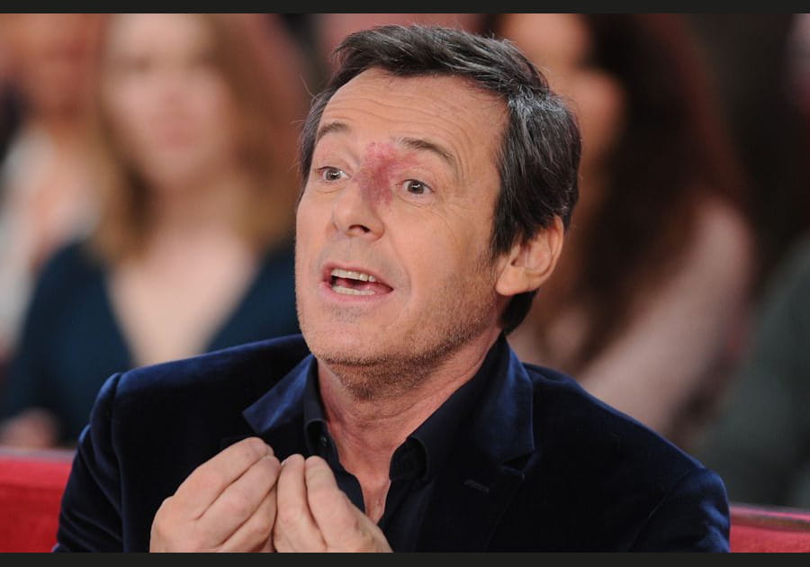 Jean-Luc Reichmann : victime d'un accident de moto