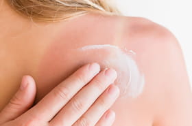 Le yaourt est-il vraiment un rem&egrave;de miracle pour les coups de soleil&nbsp;? Ce m&eacute;decin est formel