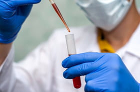 Il peut d&eacute;tecter 50&nbsp;cancers diff&eacute;rents, ce test bient&ocirc;t disponible&nbsp;?