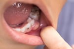 "Je ne donnerais jamais ça à mes enfants" : l'alerte des dentistes sur deux aliments