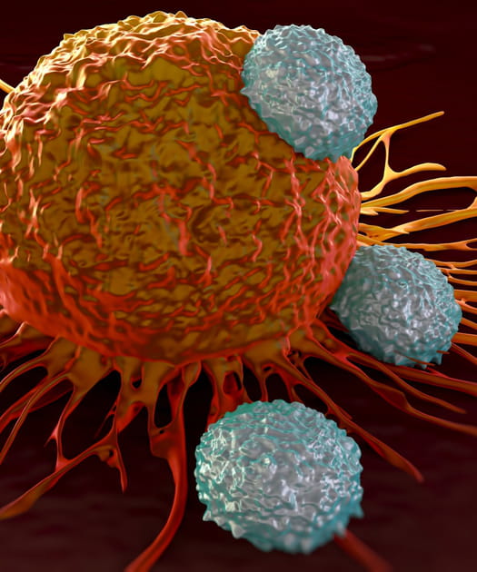 Le cancer peut produire un puissant somnif&egrave;re