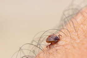 Il n'y a pas que la maladie de Lyme&nbsp;: ce virus transmis par les tiques est encore plus grave