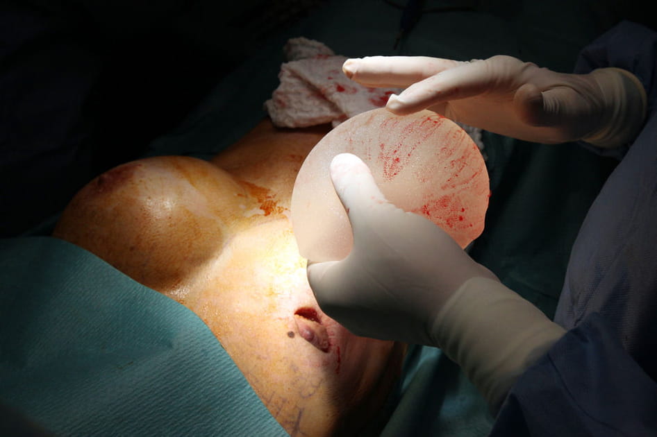 L'affaire des implants mammaires