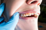 Une dentiste est formelle : "les dents jaunes ne sont pas seulement causées par une mauvaise hygiène"