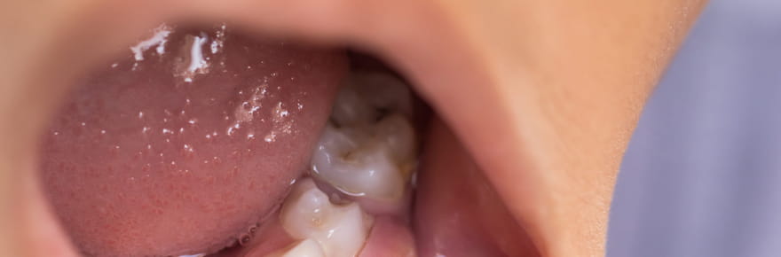 &quot;Je ne donnerais jamais &ccedil;a &agrave; mes enfants&quot;&nbsp;: l'alerte des dentistes sur deux aliments