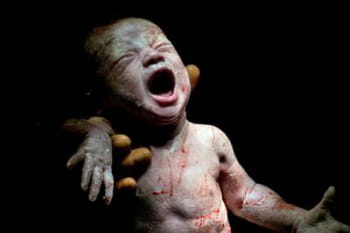 Les premières secondes d'une naissance en photo