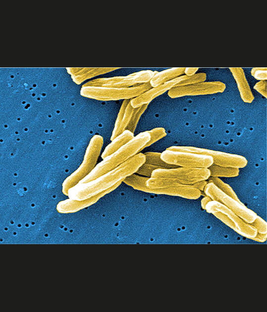Une maladie tr&egrave;s infectieuse