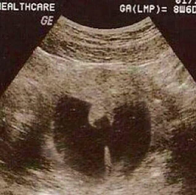 Le b&eacute;b&eacute; super h&eacute;ros