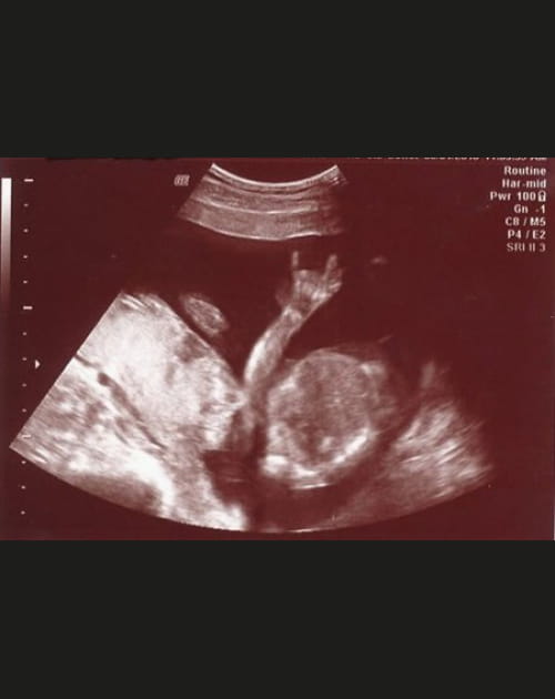 Le b&eacute;b&eacute; m&eacute;talleux