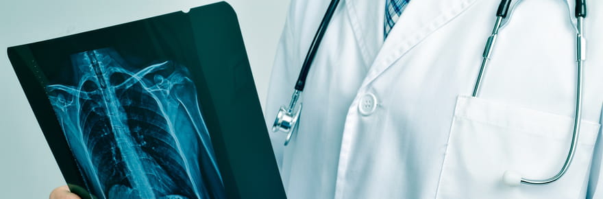 Il n'y a pas que le tabac&nbsp;: ces aliments pourraient augmenter le risque de cancer du poumon