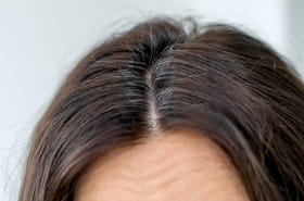 Il y a des astuces naturelles&nbsp;: comment limiter les cheveux blancs et en prendre soin&nbsp;?