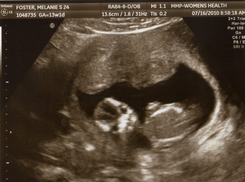 Un b&eacute;b&eacute; au faci&egrave;s inqui&eacute;tant