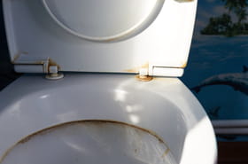 Pas besoin d'eau de Javel&nbsp;: voici comment &eacute;liminer les taches jaunes des toilettes en seulement 10&nbsp;minutes