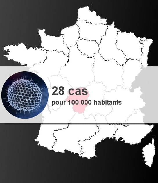 3e r&eacute;gion la plus touch&eacute;e par la varicelle : le&nbsp;Limousin