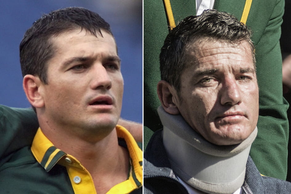 Joost Van der Westhuizen, victime de la maladie de Charcot