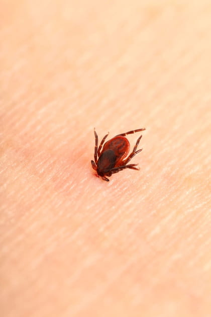 La tique et la maladie de Lyme