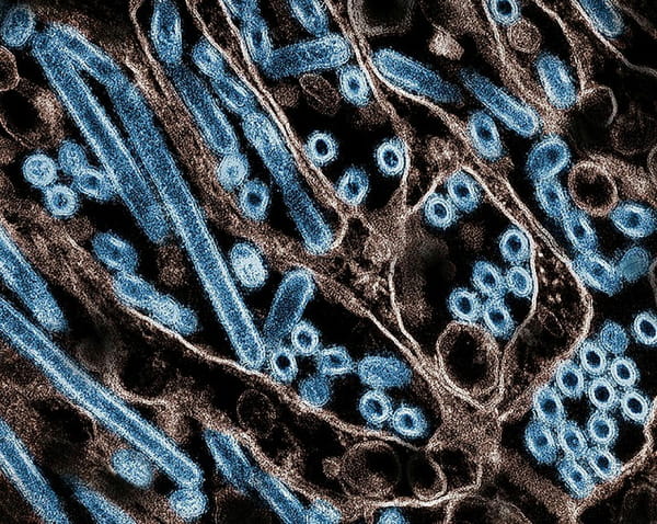 National Institute of Allergy and Infectious Diseases