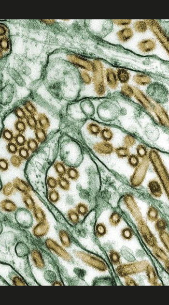 H5N1&nbsp;: la&nbsp;surveillance continue