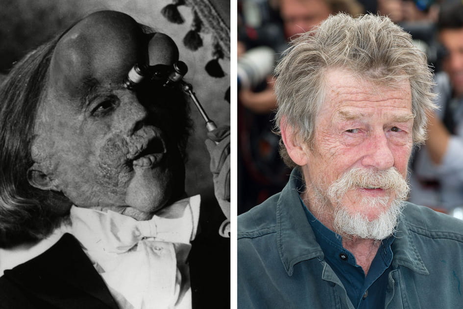 John Hurt&nbsp;: Elephant Man